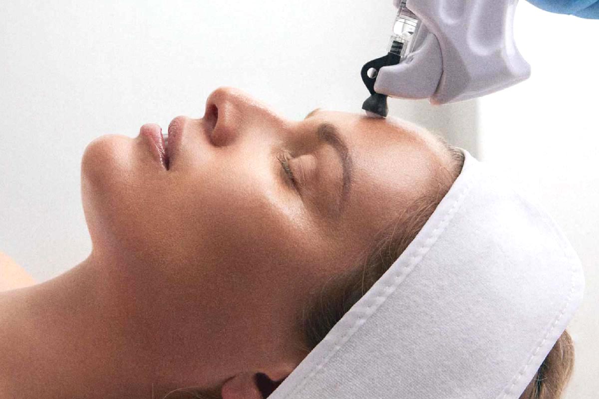 skincontact kennenlernbehandlung